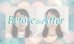 小顔ビフォーアフター【インスタ投稿】