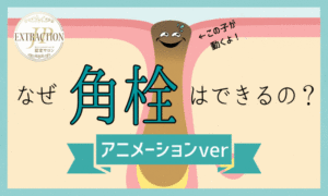 【毛穴エクストラクション】なぜ角栓はできるの？アニメーションver