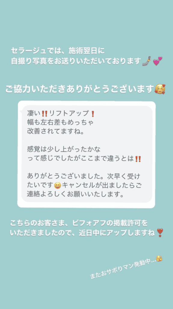 小顔･フェイスライン 左右差