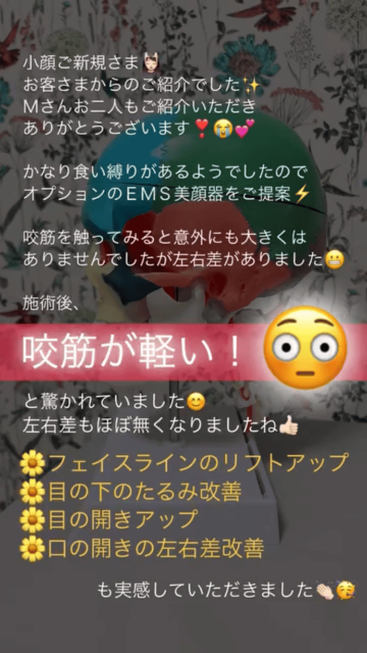 左右差 食いしばり･咬筋 小顔･フェイスライン 目の開き 顎関節･口の開き たるみ