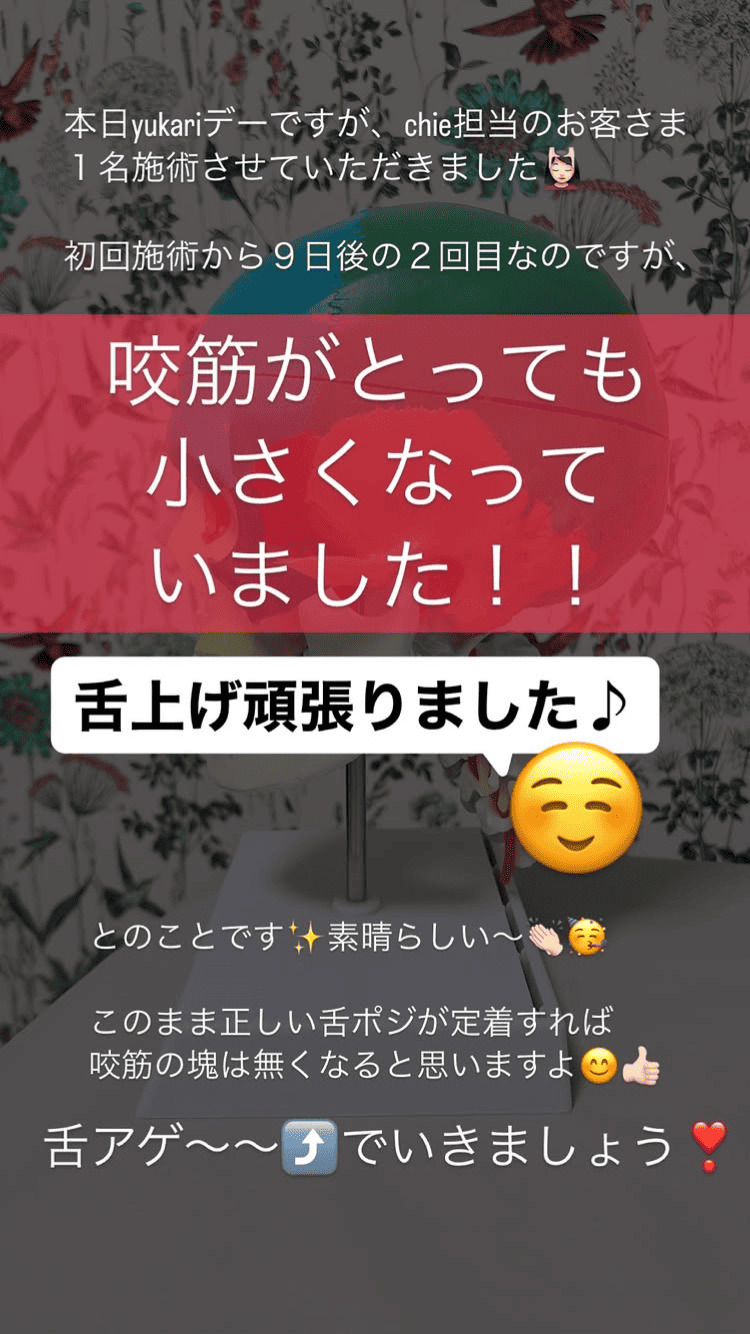 食いしばり･咬筋 舌の位置