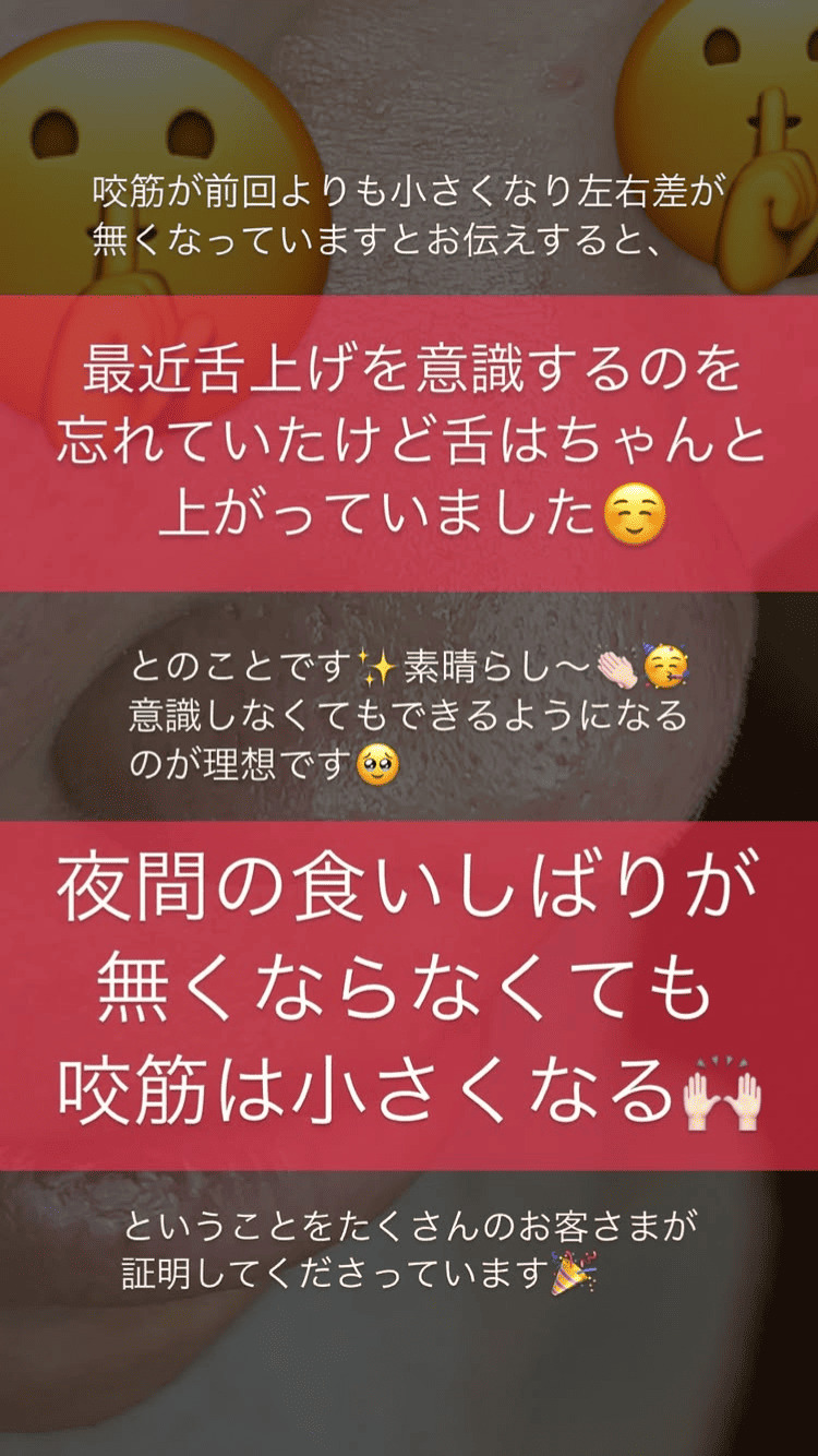 食いしばり･咬筋 舌の位置 左右差