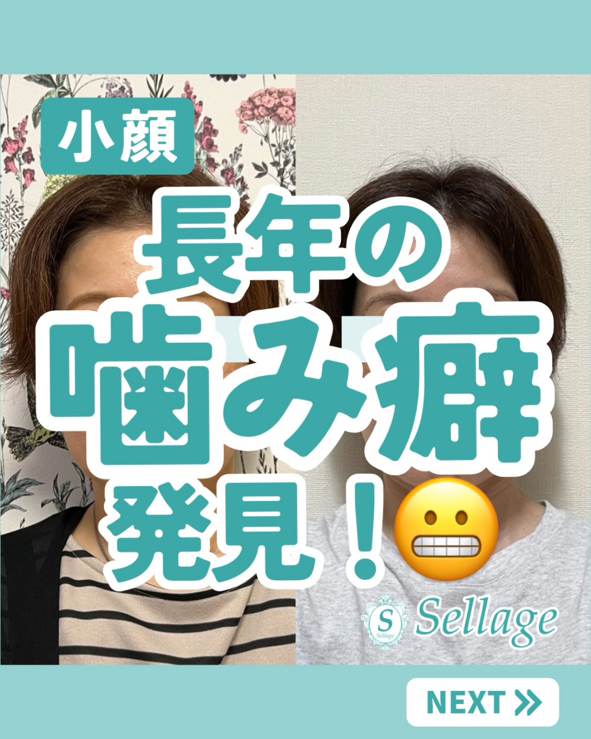 Photo by 𝒄𝒉𝒊𝒆|大阪北堀江|小顔サロン𝑺𝒆𝒍𝒍𝒂𝒈𝒆〜セラージュ〜🕊 on July 10, 2026. May be an image of text that says '小顔 長年の 喵み癖 発見！e ! S Sellage NEXT'.